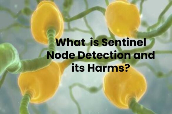What is Sentinel Node Detection and its Harms?