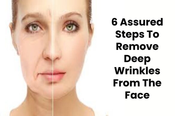 6 Assured Steps To Remove Deep Wrinkles From The Face