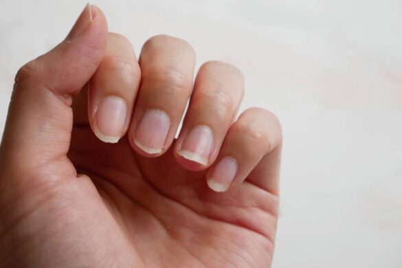 12 Secrets your Nails Tell about your Health