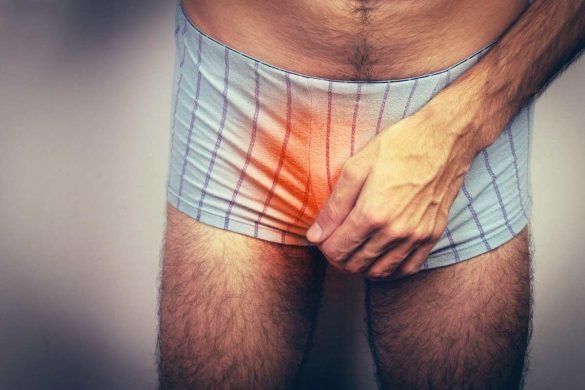 Pearly Penile Papules