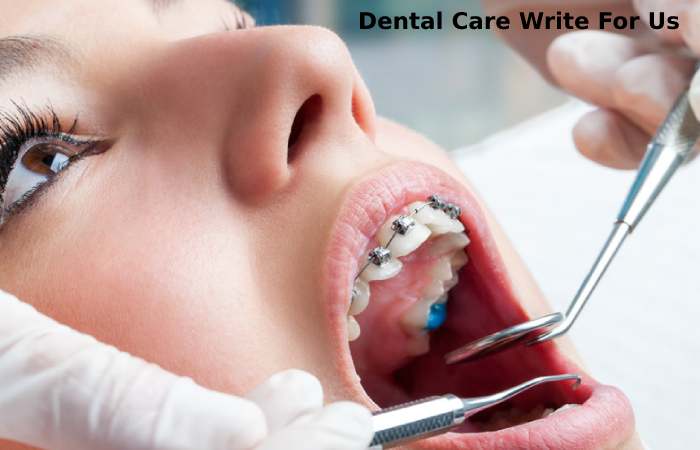 Dental Care Write For Us