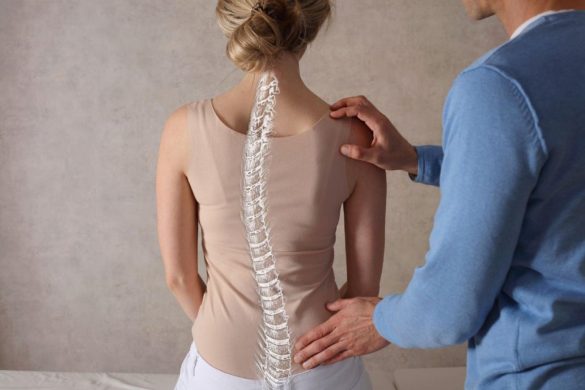 Scoliosis Unveiled Your Comprehensive Guide
