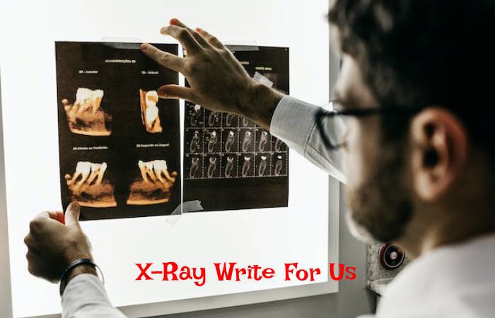 X-Ray Write For Us