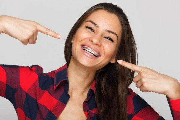 How to Choose the Right Adult Braces for Your Lifestyle