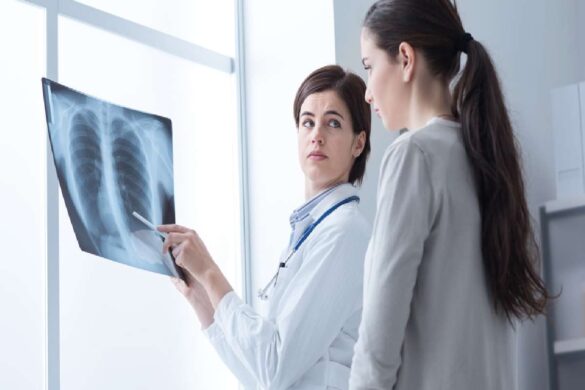 Things You Should Know About Pneumonia