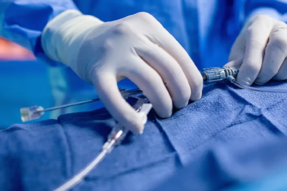 Minimally Invasive Procedures